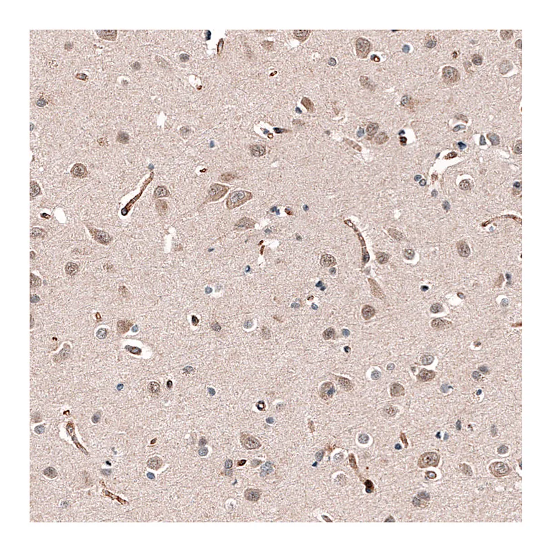 Atlas Antibodies Anti-SHC3 Antibody