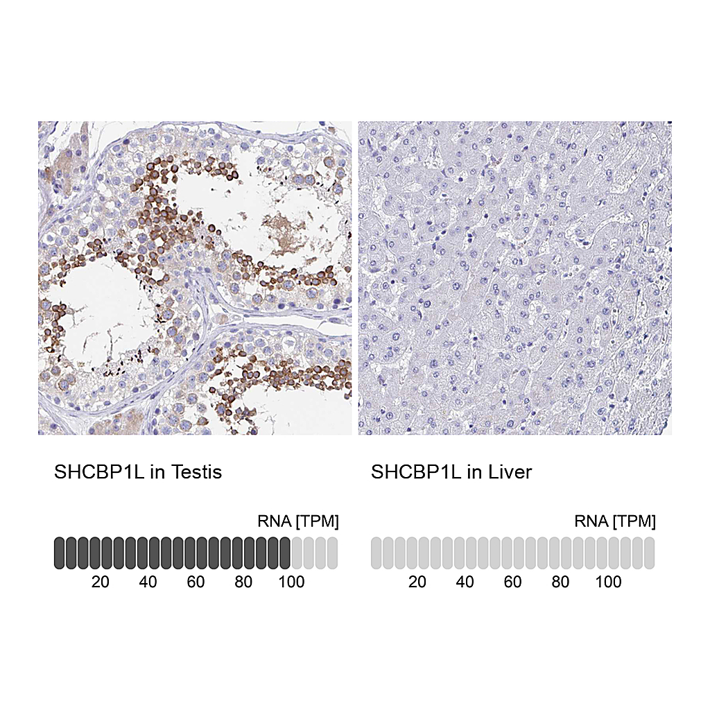 Atlas Antibodies Anti-SHCBP1L Antibody