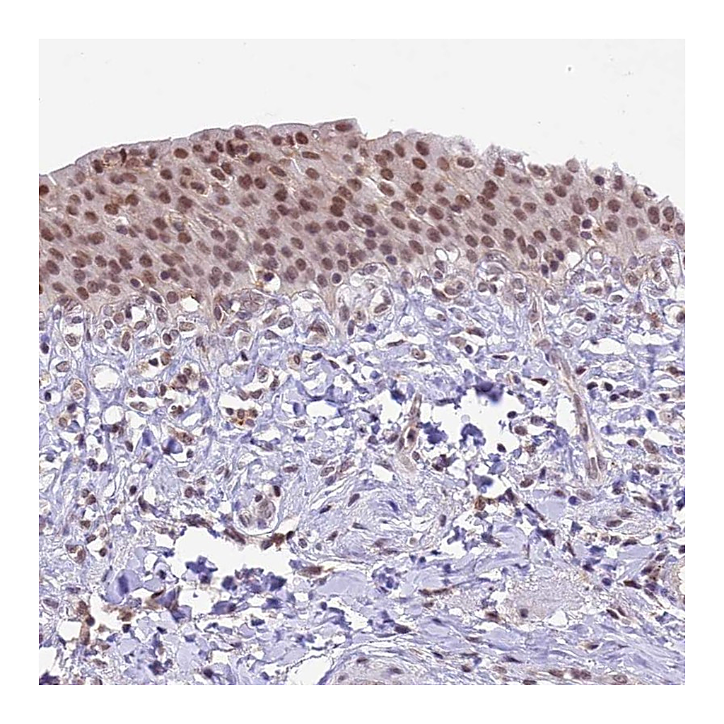 Atlas Antibodies Anti-SHKBP1 Antibody