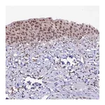 Atlas Antibodies Anti-SHKBP1 Antibody