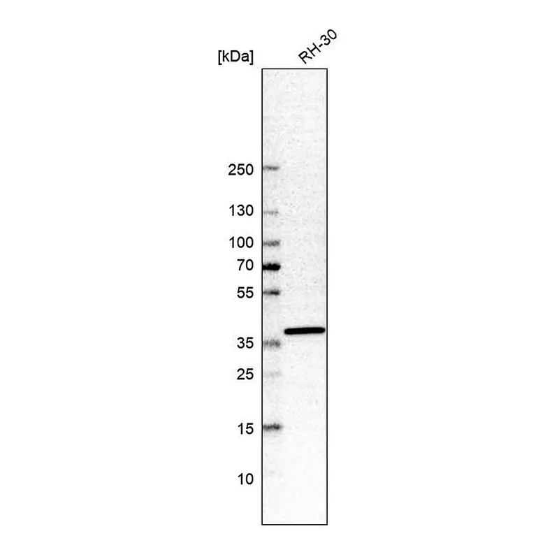 Atlas Antibodies Anti-SHISA2 Antibody