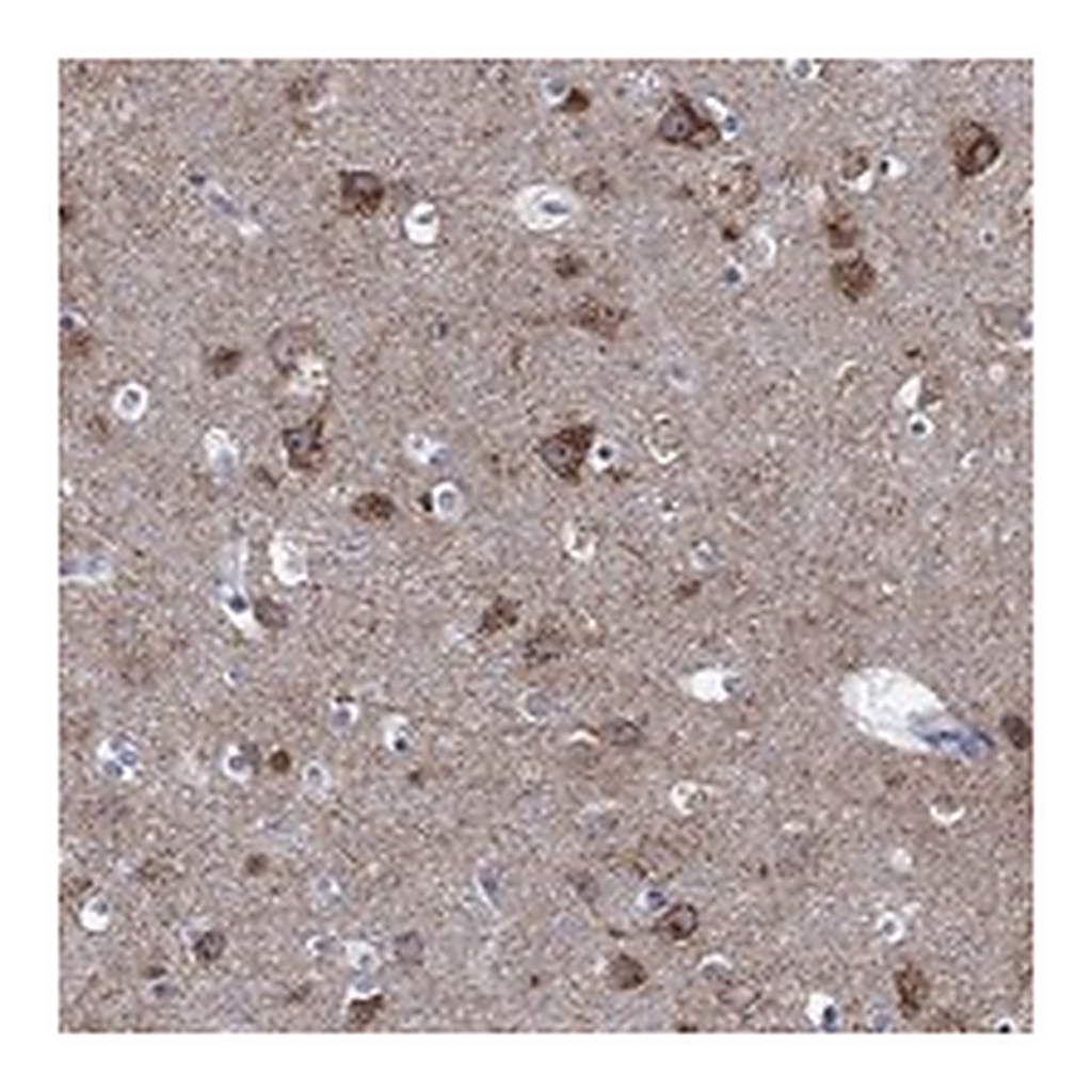 Atlas Antibodies Anti-SHOC2 Antibody
