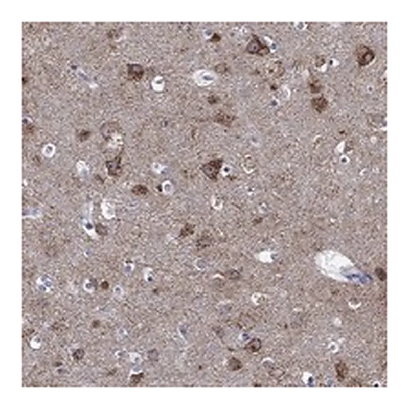 Atlas Antibodies Anti-SHOC2 Antibody
