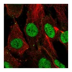 Atlas Antibodies Anti-SHOX Antibody