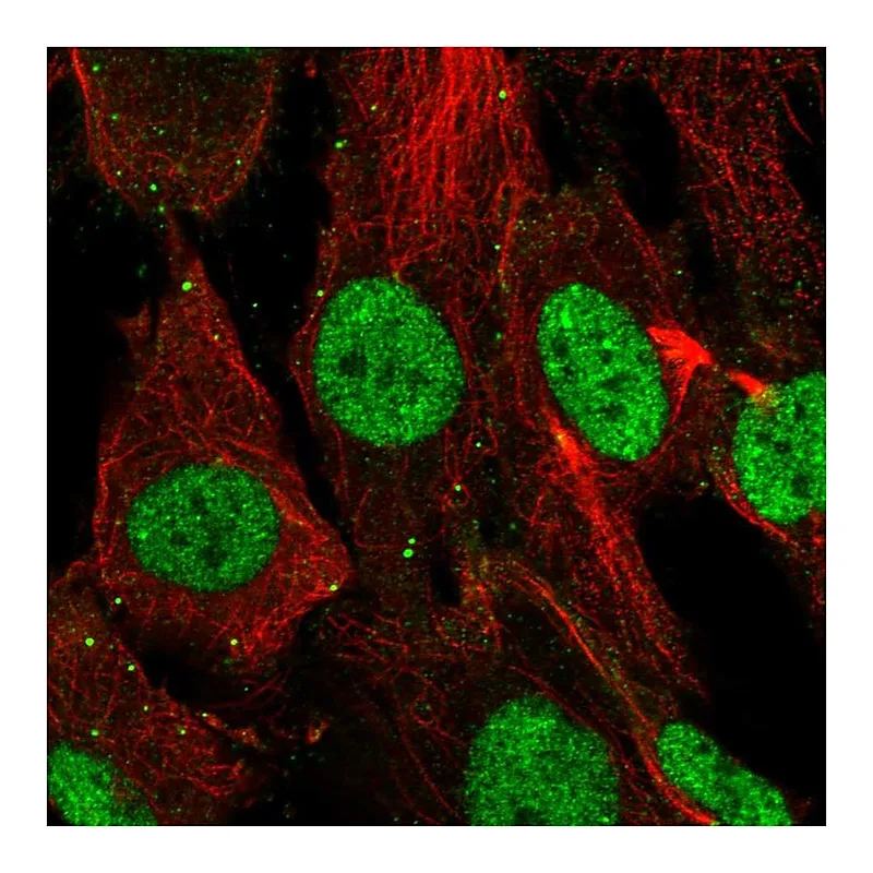 Atlas Antibodies Anti-SHOX Antibody