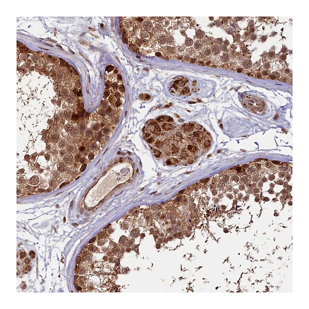 Atlas Antibodies Anti-SHPRH Antibody