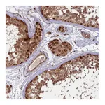 Atlas Antibodies Anti-SHPRH Antibody