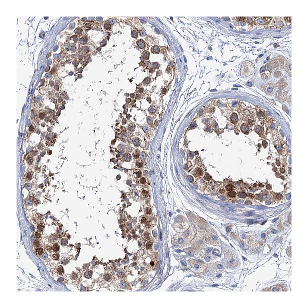 Atlas Antibodies Anti-SHE Antibody