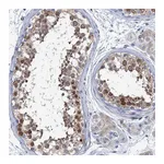 Atlas Antibodies Anti-SHE Antibody