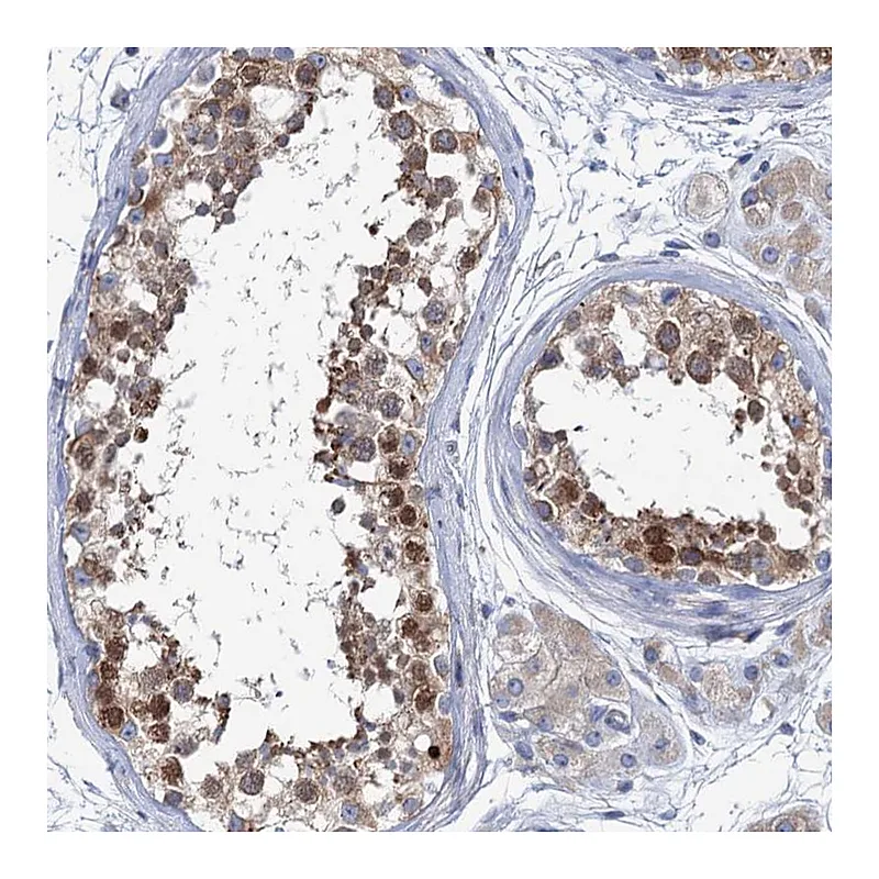 Atlas Antibodies Anti-SHE Antibody