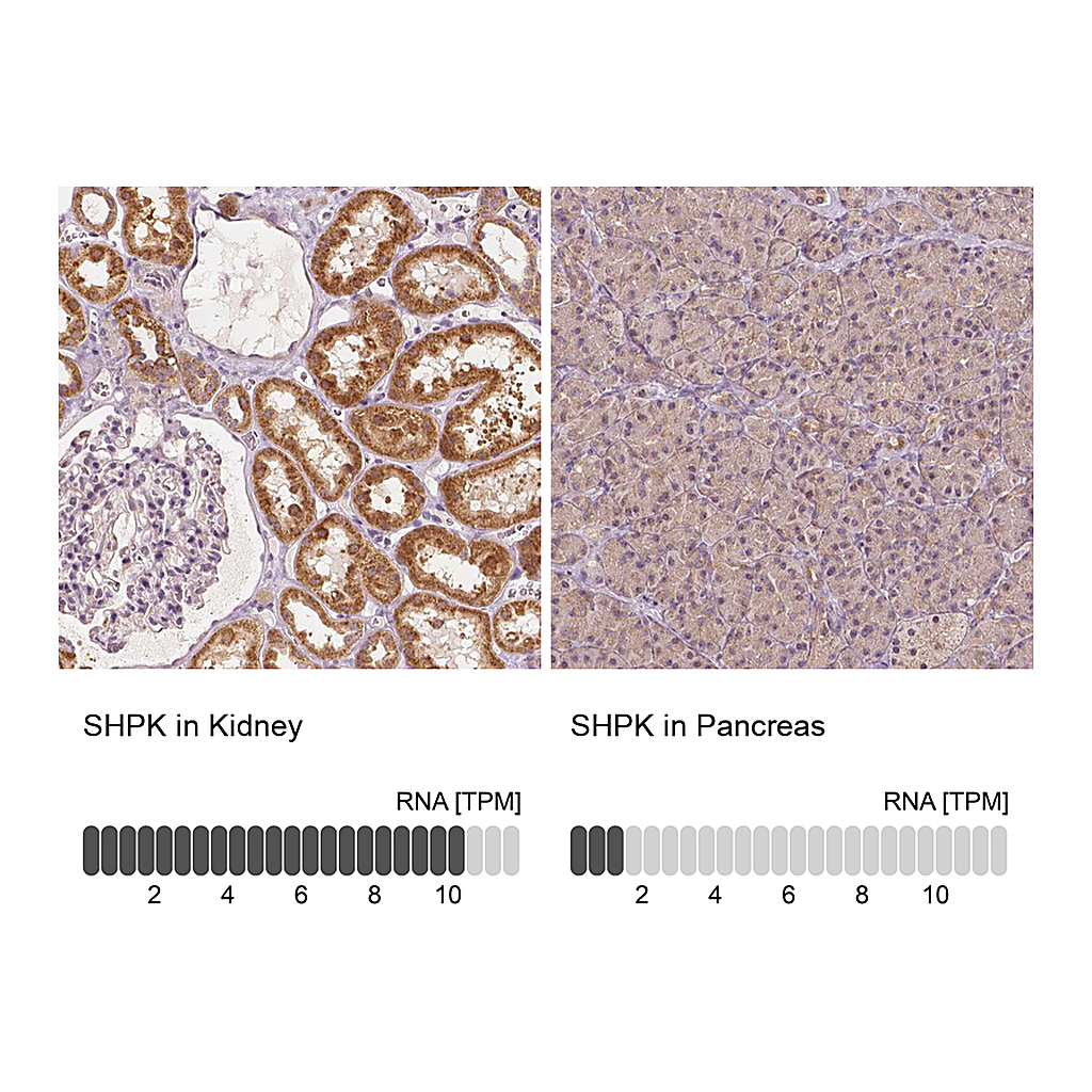 Atlas Antibodies Anti-SHPK Antibody