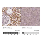 Atlas Antibodies Anti-SHPK Antibody
