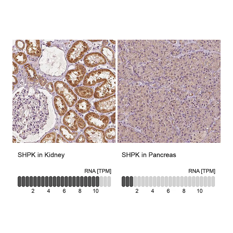 Atlas Antibodies Anti-SHPK Antibody