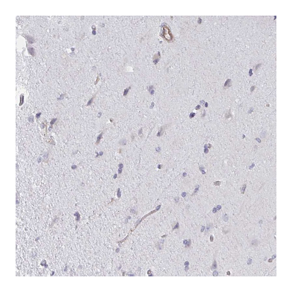 Atlas Antibodies Anti-SHISA7 Antibody