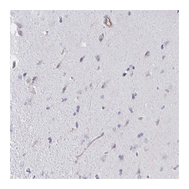 Atlas Antibodies Anti-SHISA7 Antibody