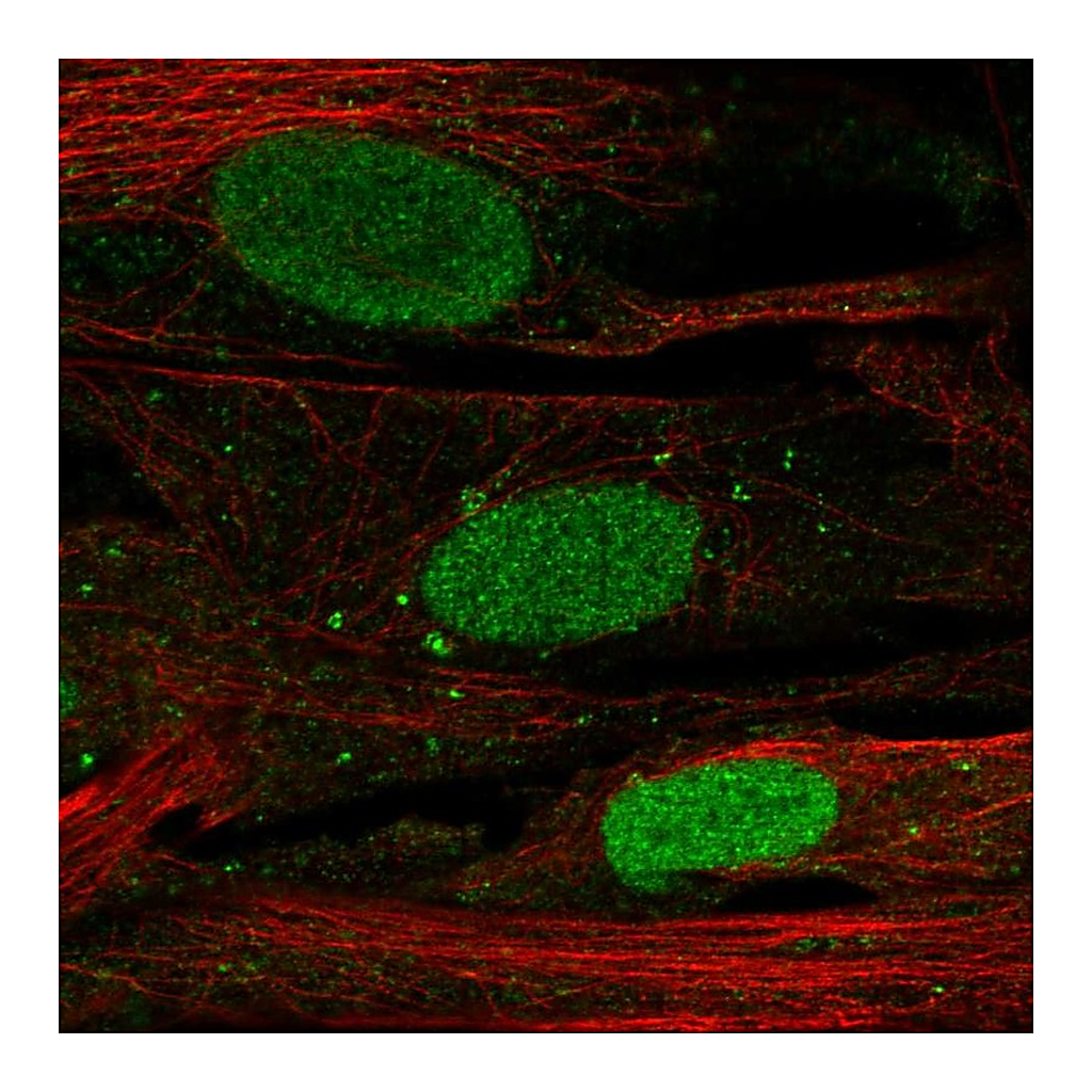 Atlas Antibodies Anti-SHOX Antibody
