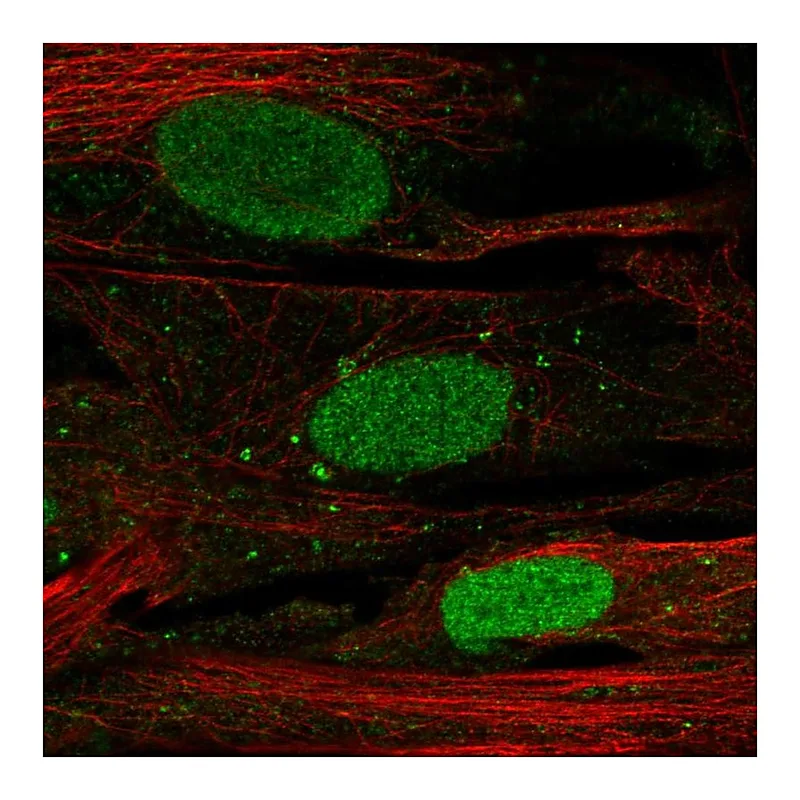 Atlas Antibodies Anti-SHOX Antibody