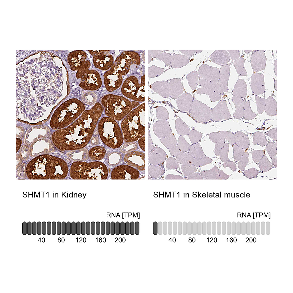Atlas Antibodies Anti-SHMT1 Antibody
