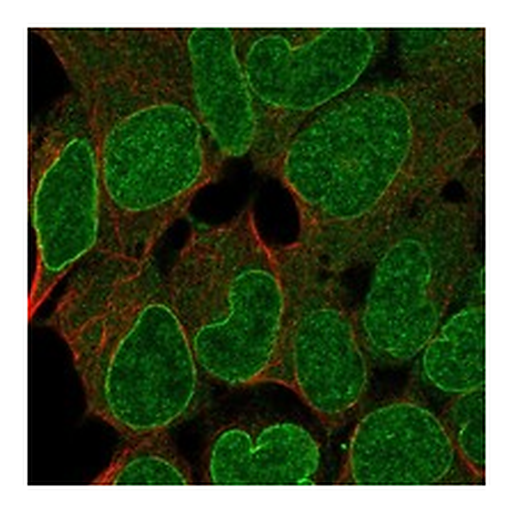 Atlas Antibodies Anti-SHPRH Antibody