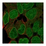 Atlas Antibodies Anti-SHPRH Antibody