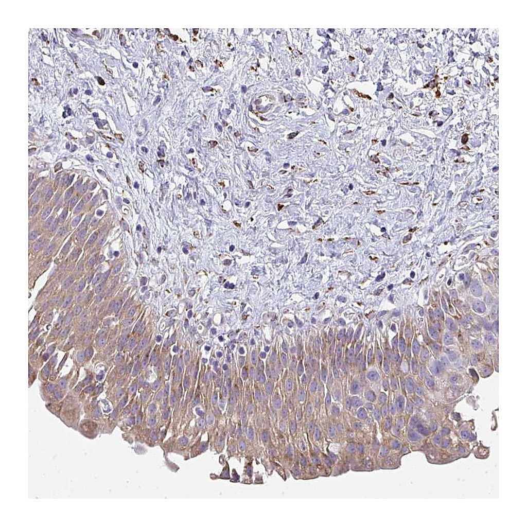 Atlas Antibodies Anti-SHROOM1 Antibody