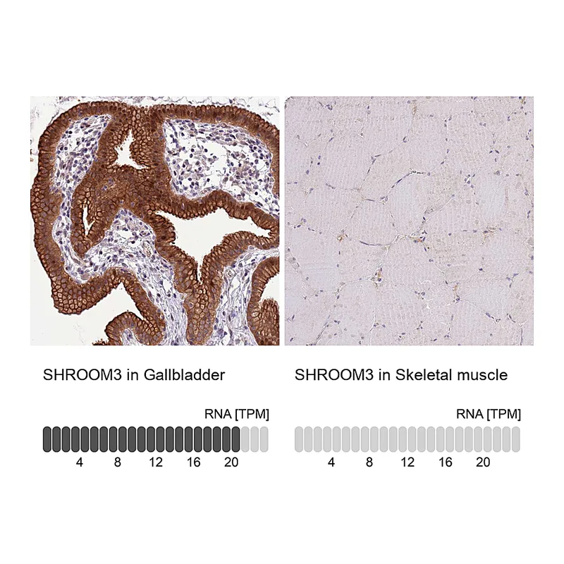 Atlas Antibodies Anti-SHROOM3 Antibody