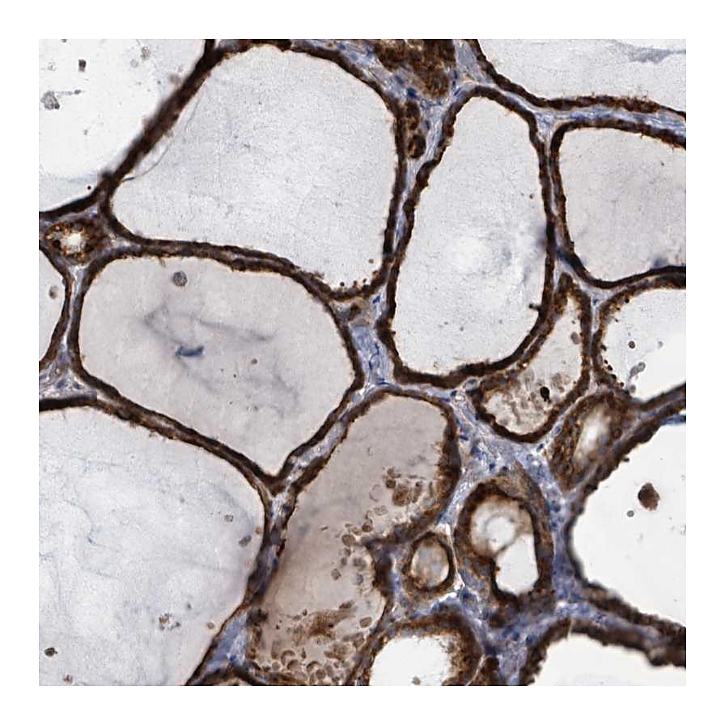 Atlas Antibodies Anti-SHROOM2 Antibody