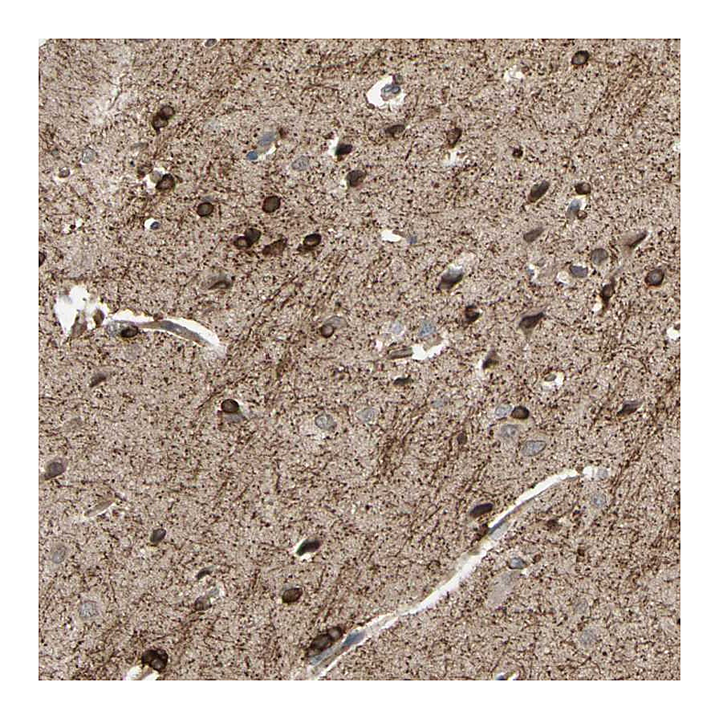 Atlas Antibodies Anti-SHROOM4 Antibody