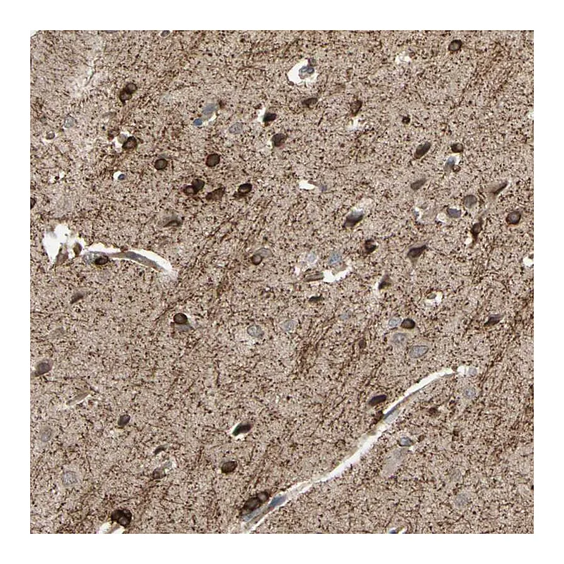 Atlas Antibodies Anti-SHROOM4 Antibody