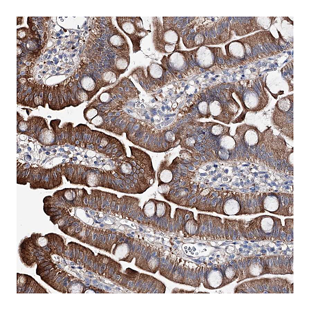 Atlas Antibodies Anti-SHROOM1 Antibody