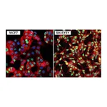 Thermo Fisher Scientific Goat anti-Rabbit IgG (H+L) Secondary Antibody, DyLight 488