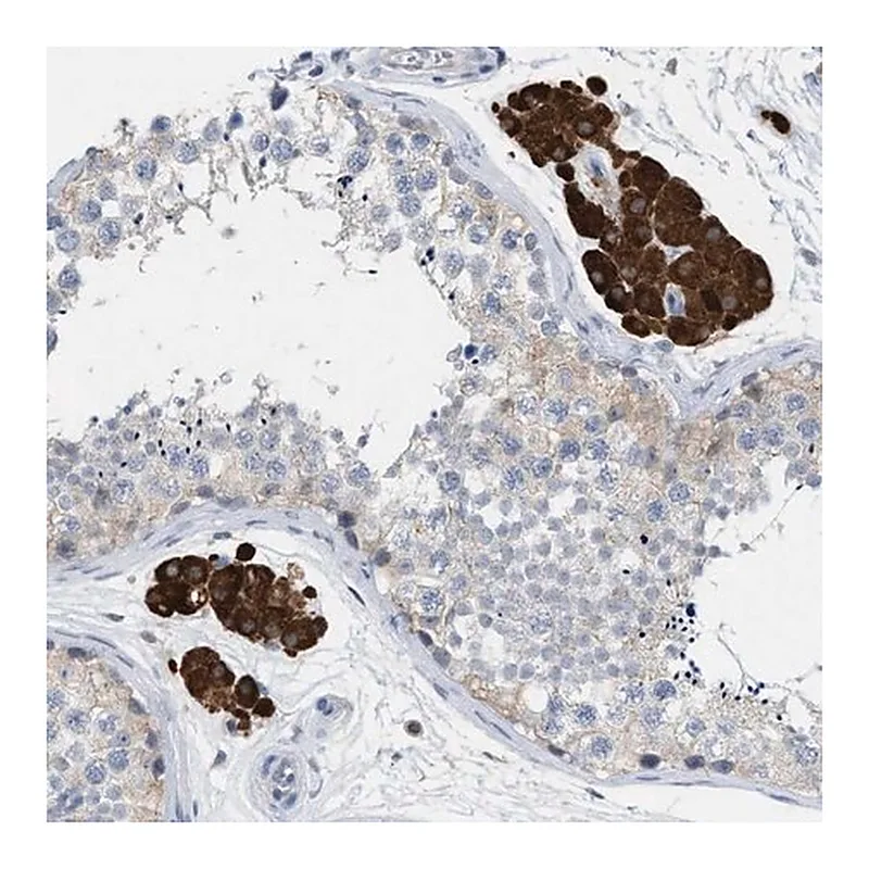 Merck Anti-PPM1D antibody produced in rabbit