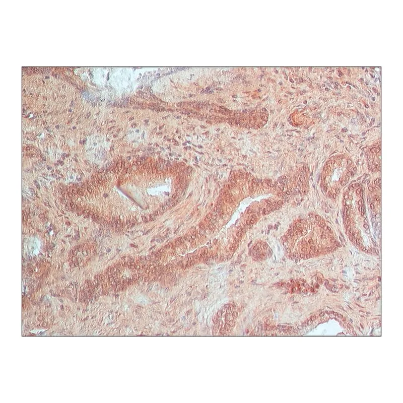 Merck Anti-Androgen Receptor antibody produced in rabbit