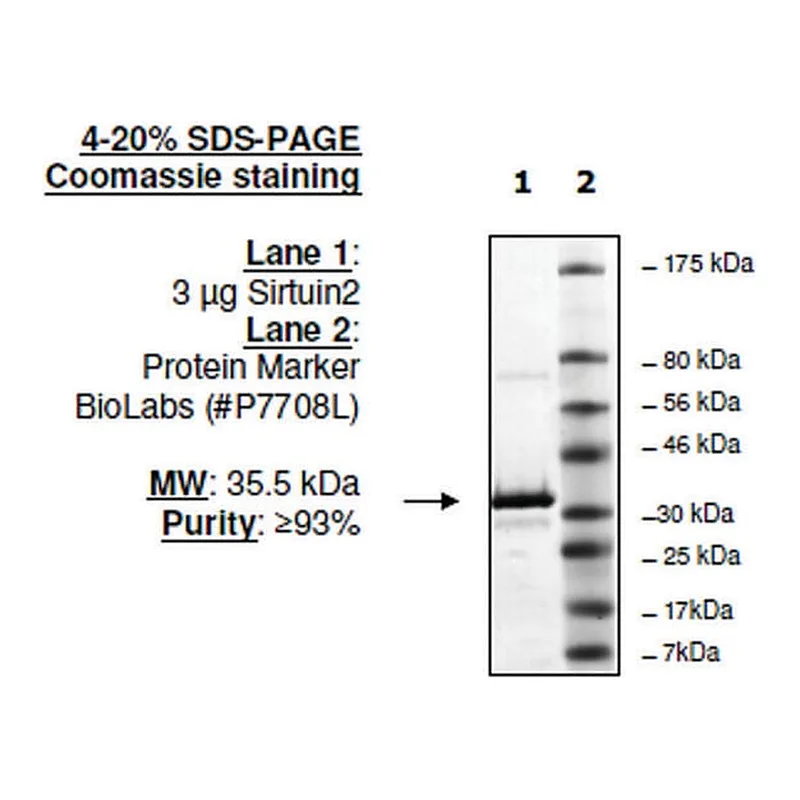 Merck Sirtuin 2 human