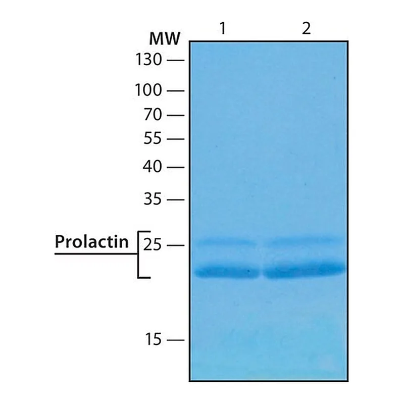 Merck Prolactin human