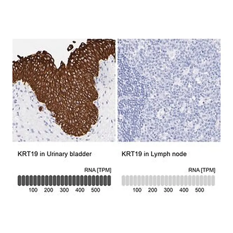 Merck ANTI-KRT19