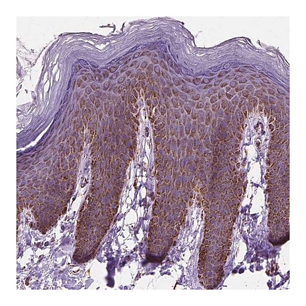 Merck Anti-RMDN3 antibody produced in rabbit
