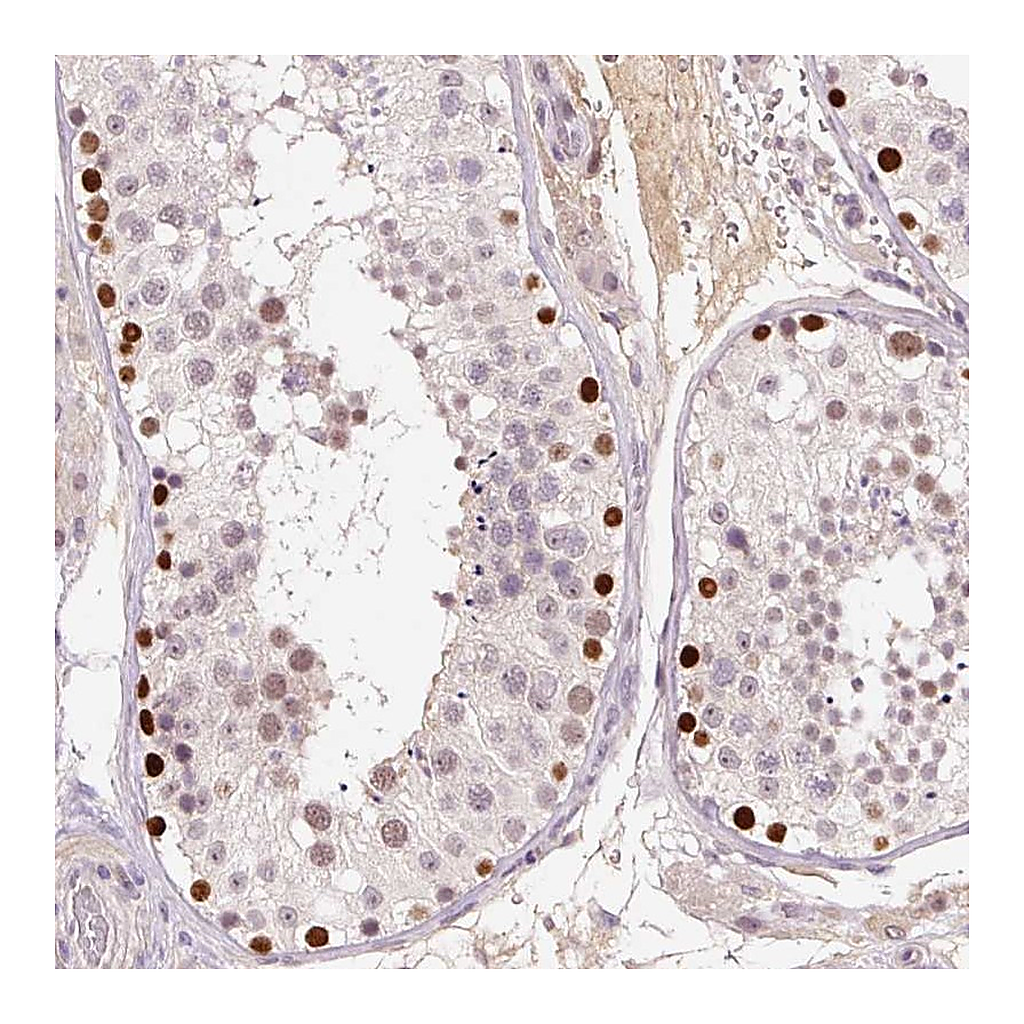 Atlas Antibodies Anti-DPPA4 Antibody