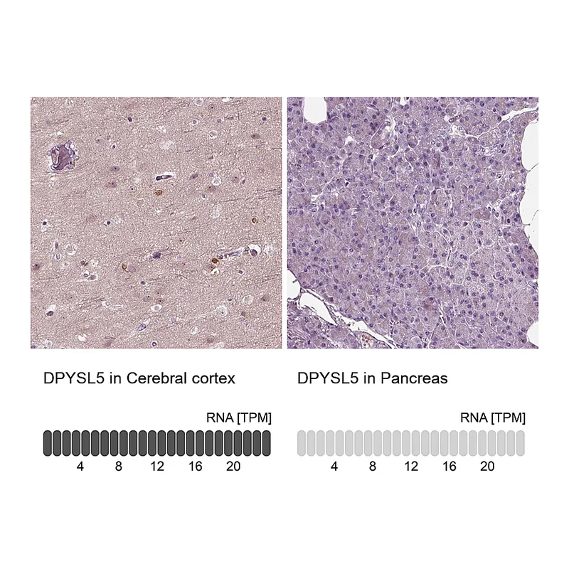 Atlas Antibodies Anti-DPYSL5 Antibody