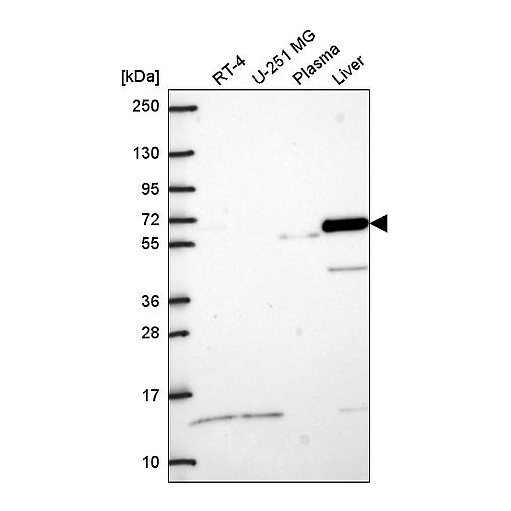 Atlas Antibodies Anti-DPYSL5 Antibody