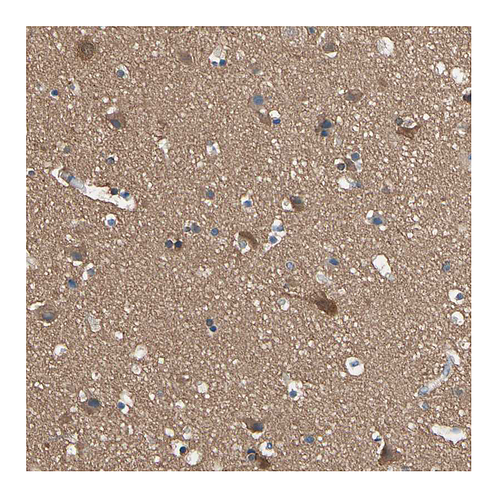 Atlas Antibodies Anti-DPYSL3 Antibody
