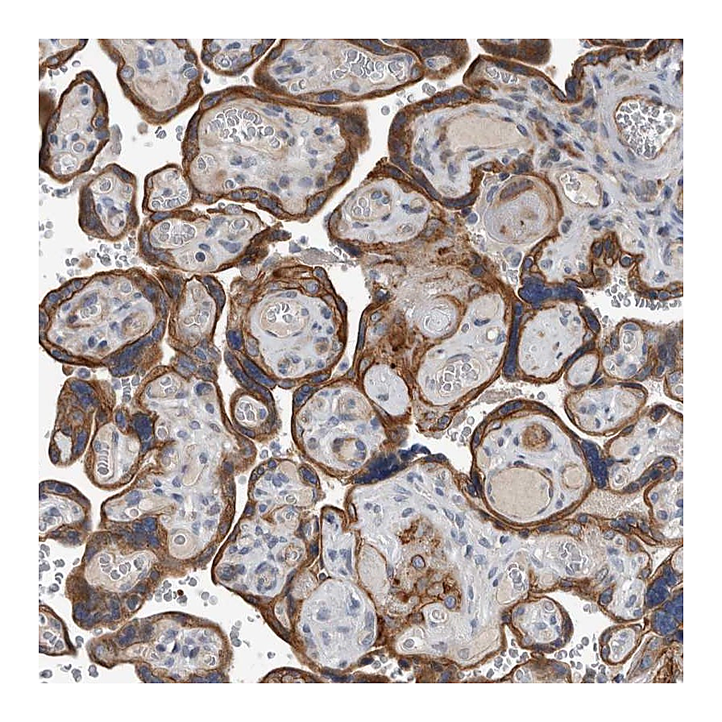Atlas Antibodies Anti-DPY19L4 Antibody