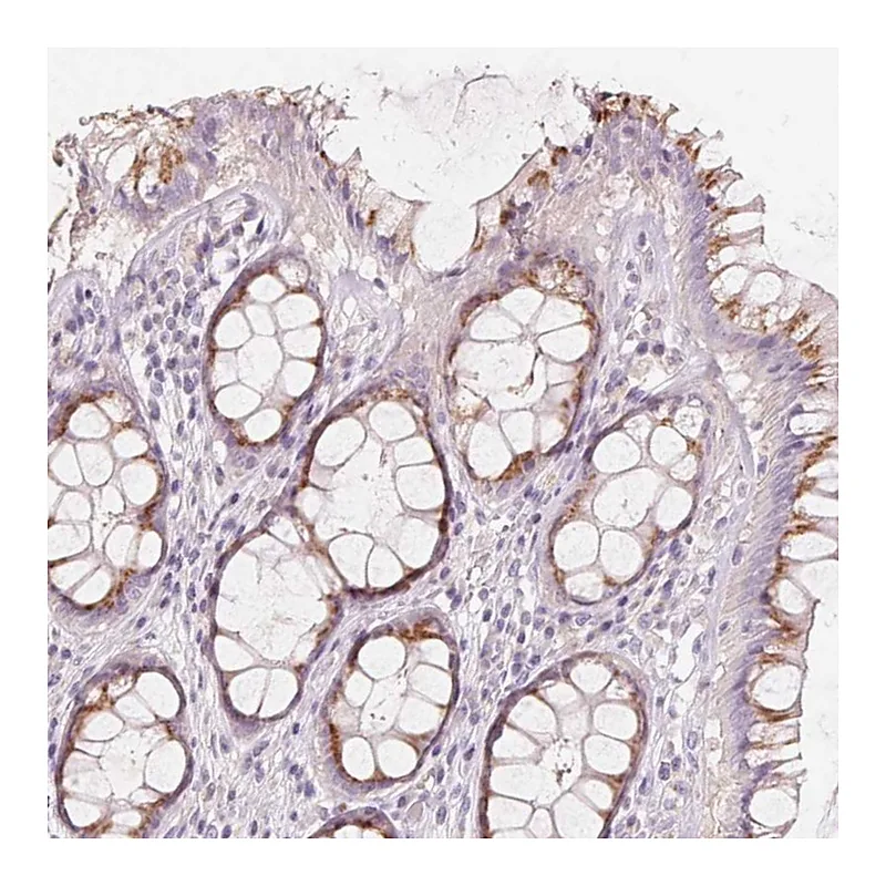 Atlas Antibodies Anti-DRAM2 Antibody