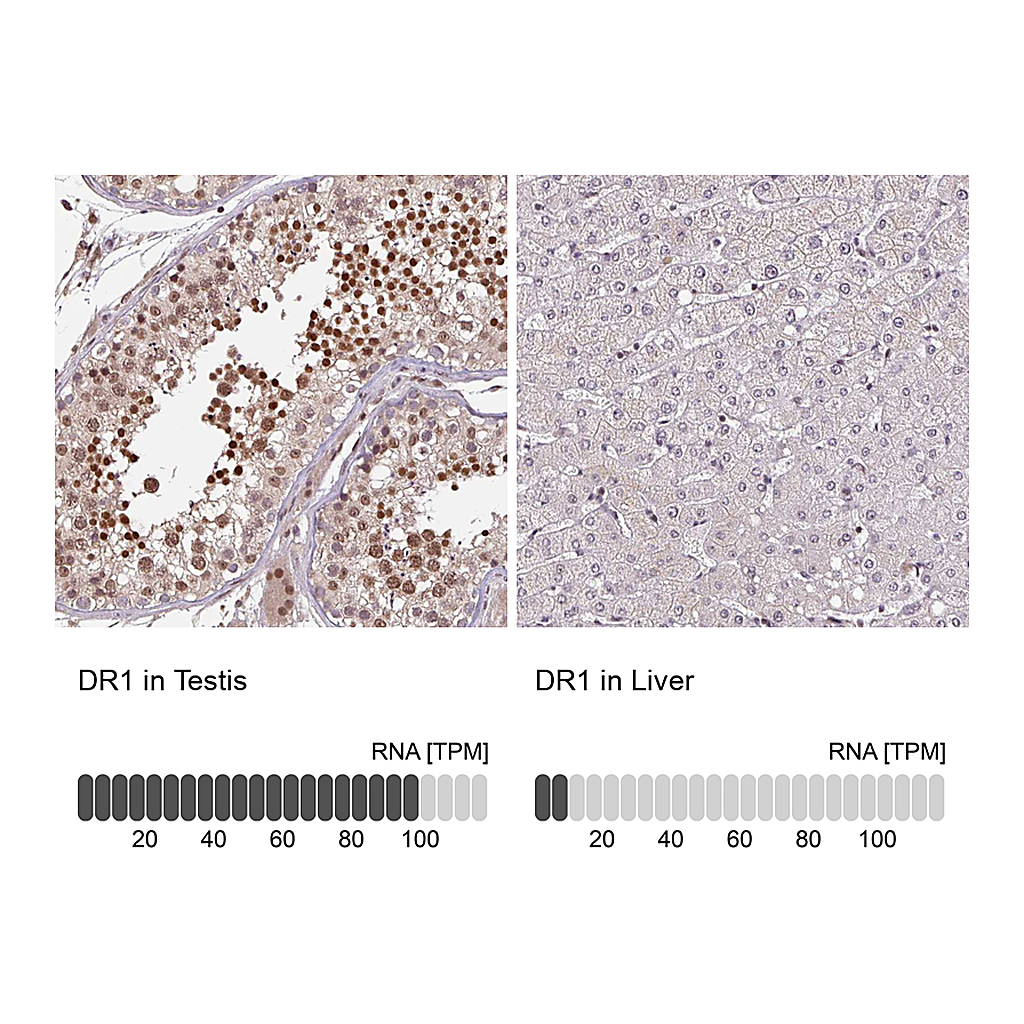 Atlas Antibodies Anti-DR1 Antibody