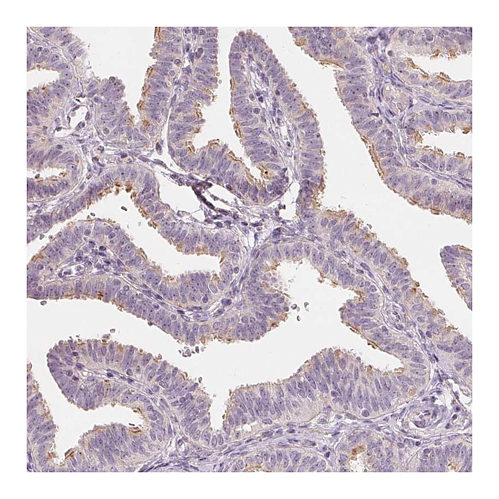 Atlas Antibodies Anti-DRC3 Antibody
