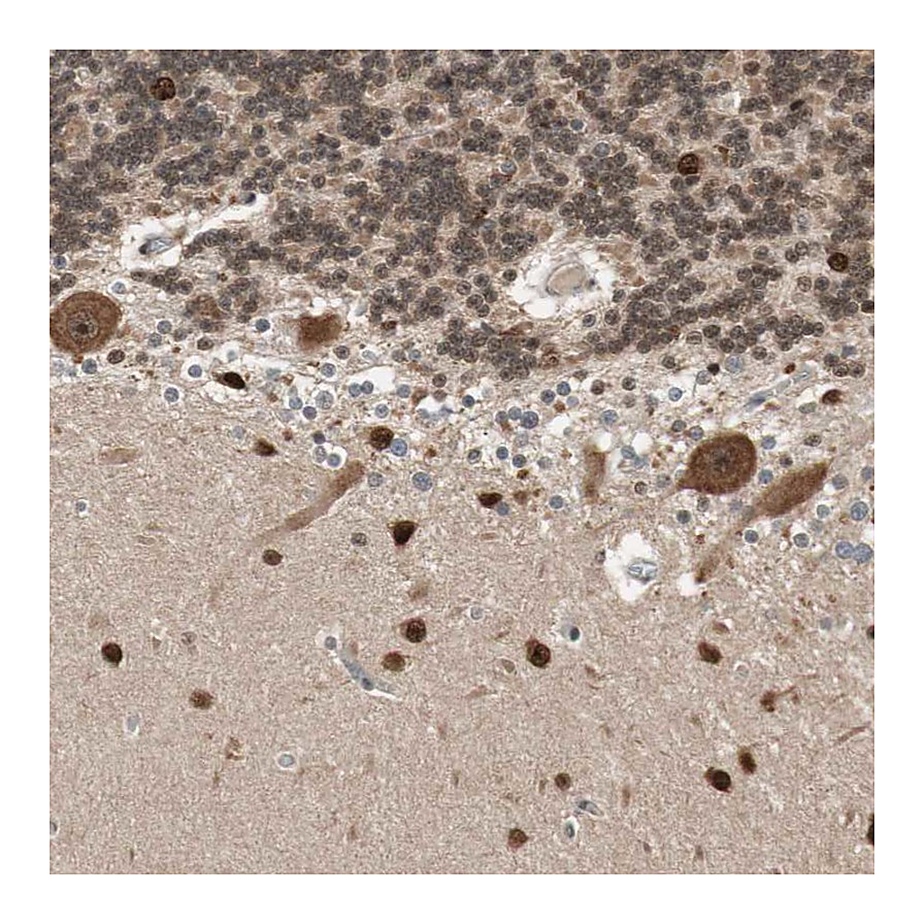 Atlas Antibodies Anti-DRAP1 Antibody