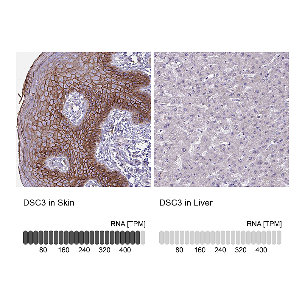 Atlas Antibodies Anti-DSC3 Antibody