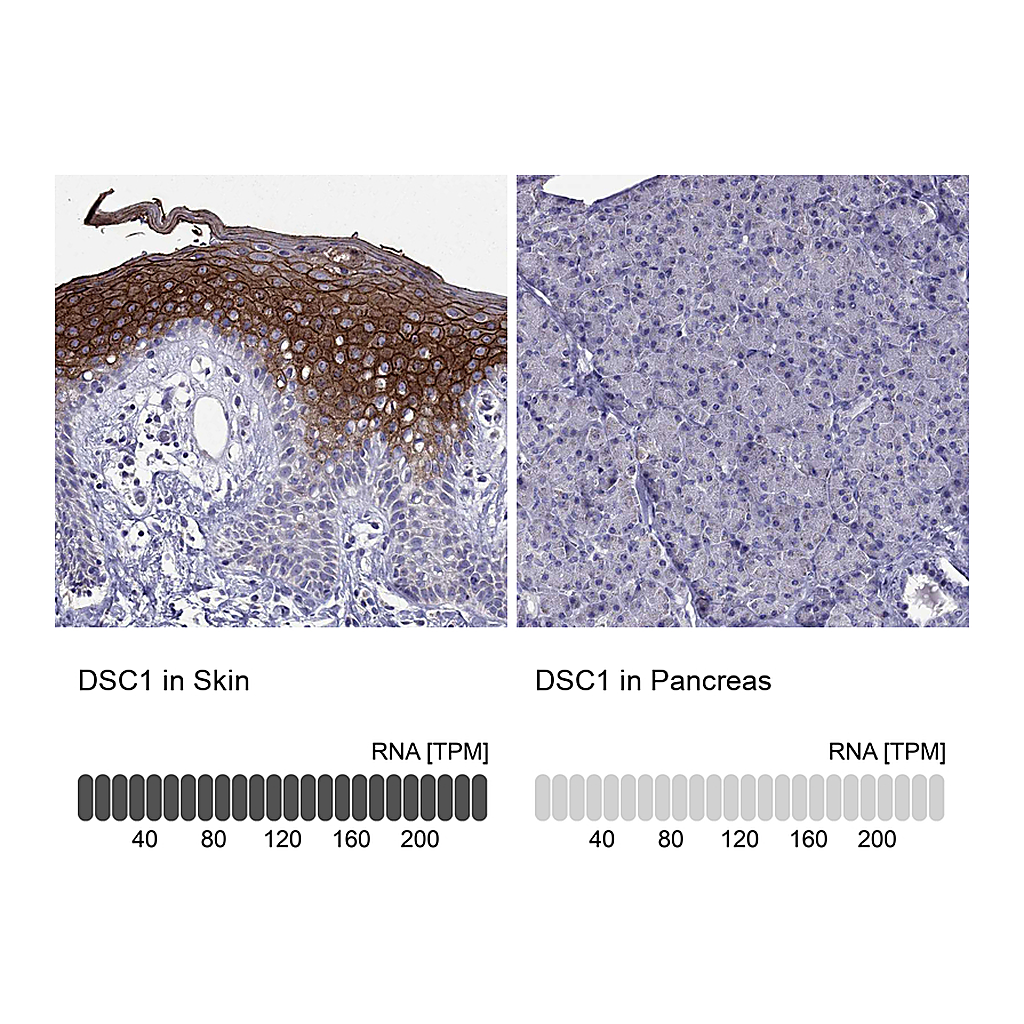 Atlas Antibodies Anti-DSC1 Antibody