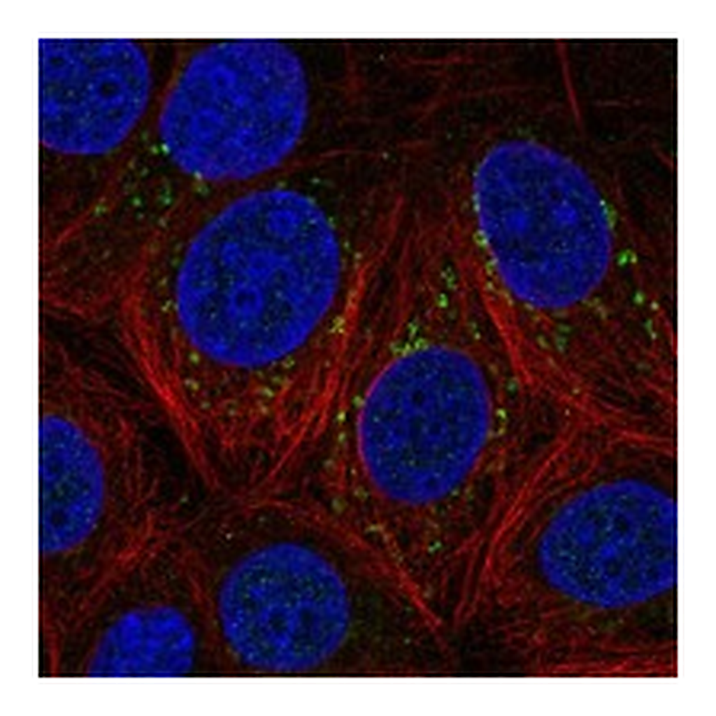 Atlas Antibodies Anti-DSCAM Antibody