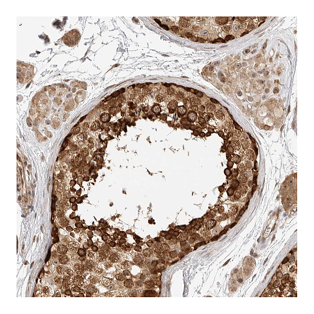 Atlas Antibodies Anti-DSCC1 Antibody